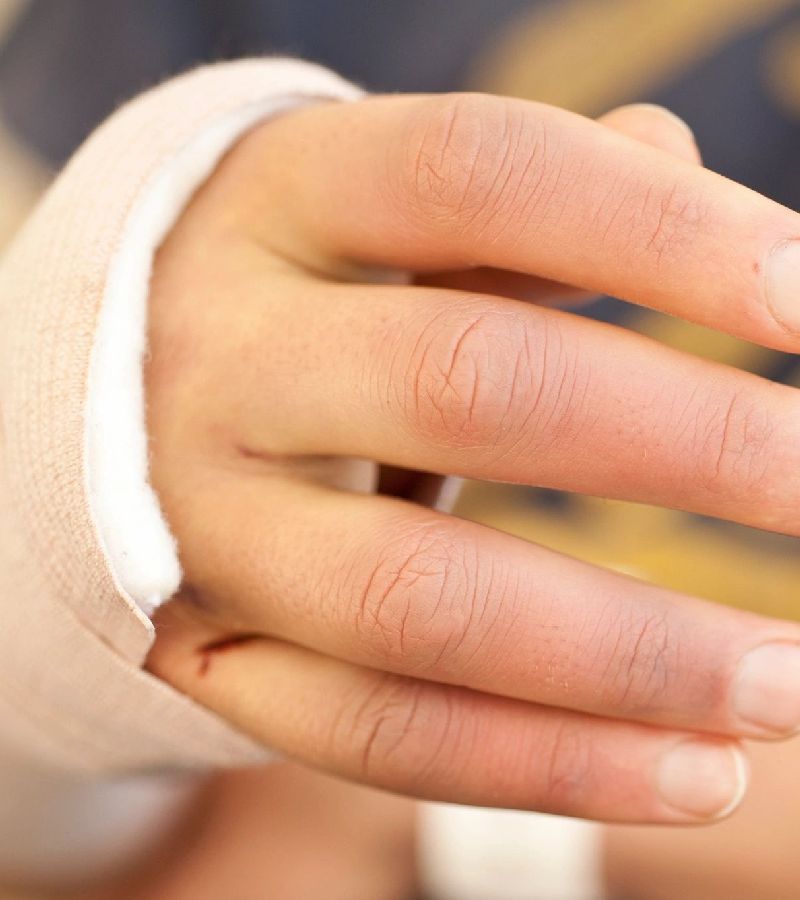 Patient's hand bandaged and in a cast